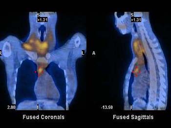 208 Spect CT widhalm