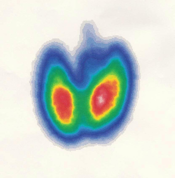 219 c Basedow Scan Original2