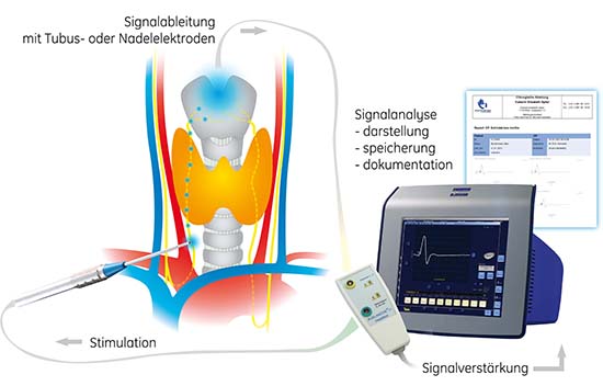302b Schilddrüsenmodell BCS Rec Eintritt weiter kaudal