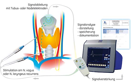 313b Schilddrüsenmodell Stimulation Handsonde an Vagus und Recurrens