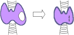 schdruese tab1