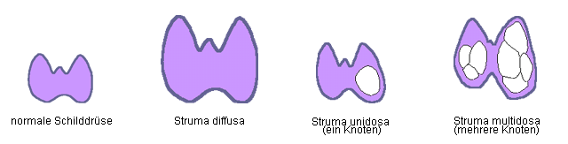 schilddruesen