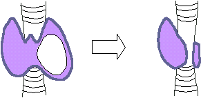subtotale